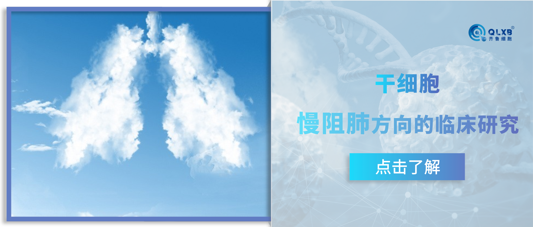 案例分享 | 干细胞慢阻肺方向的临床研究，或可让呼吸顺畅无“阻”