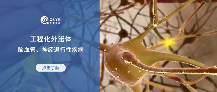 科普日常 | 工程化外泌体用于脑血管和神经退行性疾病的治疗