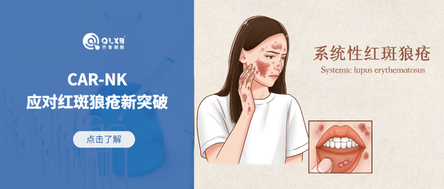“CAR”技术新可能，应对红斑狼疮再获新突破