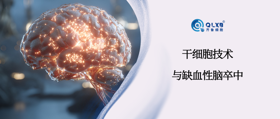 案例分享 | 592名受试者：干细胞技术降低缺血性中风死亡率
