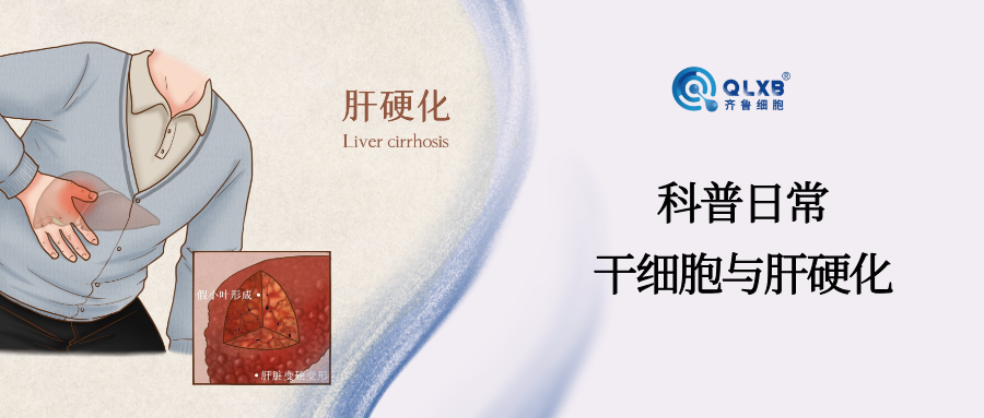 科普日常 | 当肝硬化遇上干细胞，点亮健康希望