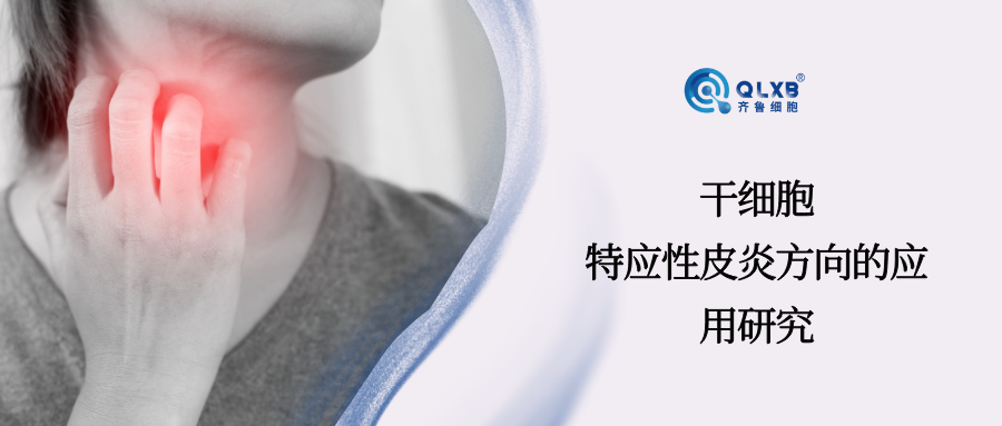 案例分享 | 干细胞，应对特应性皮炎的新希望
