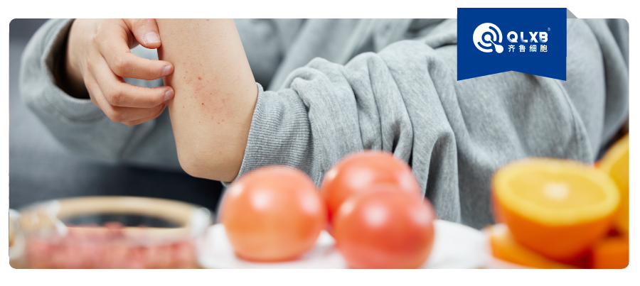 案例分享 | 备受过敏困扰？间充质干细胞在过敏性疾病中的研究与展望