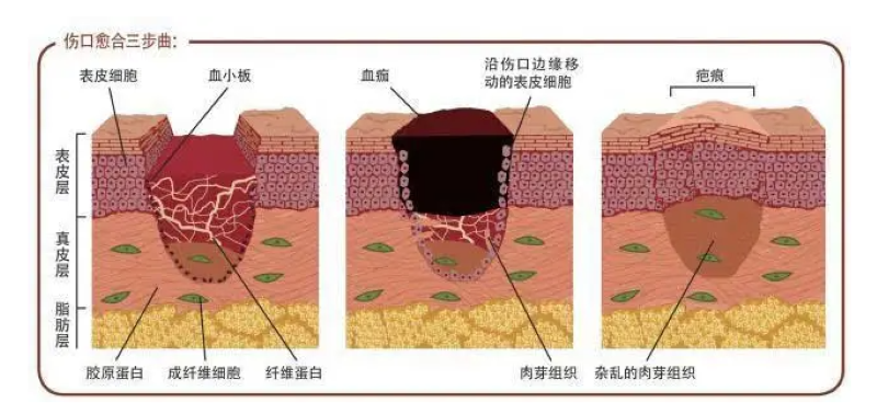 自体细胞储存